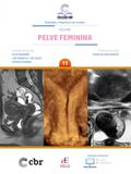 Coleção CBR Volume 11 Pelve Feminina