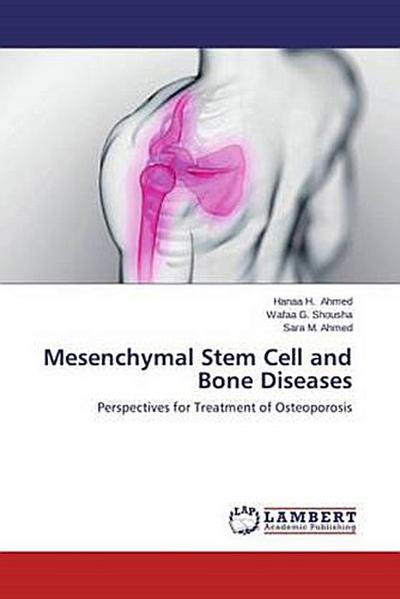 Mesenchymal Stem Cell and Bone Diseases