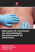 Aplicação da simulação em dermatologia: dermatoscopia do melanoma