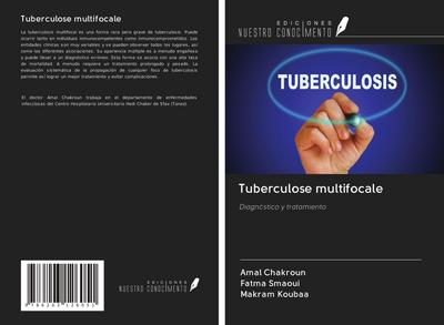 Tuberculose multifocale