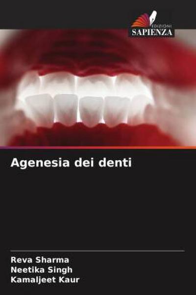 Agenesia dei denti