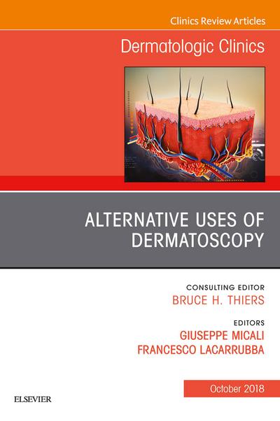 Alternative Uses of Dermatoscopy, An Issue of Dermatologic Clinics