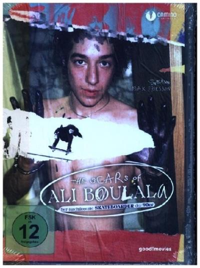 The Scars of Ali Boulala