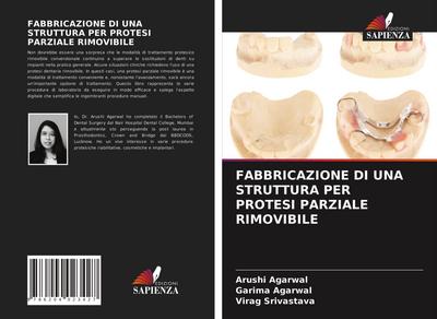 FABBRICAZIONE DI UNA STRUTTURA PER PROTESI PARZIALE RIMOVIBILE