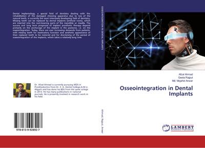 Osseointegration in Dental Implants