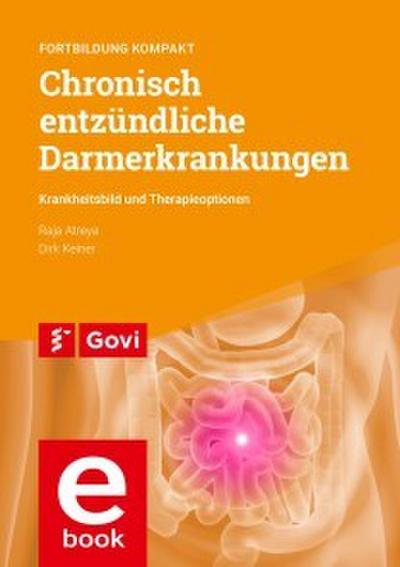 Chronisch entzündliche Darmerkrankungen - Krankheitsbild und Therapieoptionen