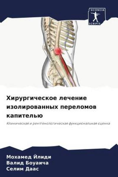 Hirurgicheskoe lechenie izolirowannyh perelomow kapitel’ü