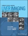 Liver Imaging