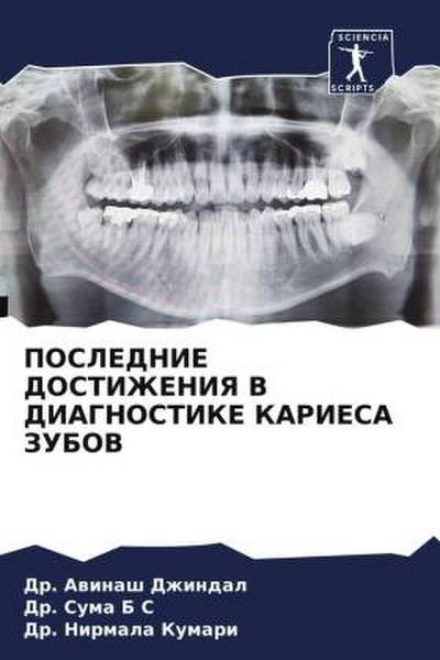 POSLEDNIE DOSTIZhENIYa V DIAGNOSTIKE KARIESA ZUBOV