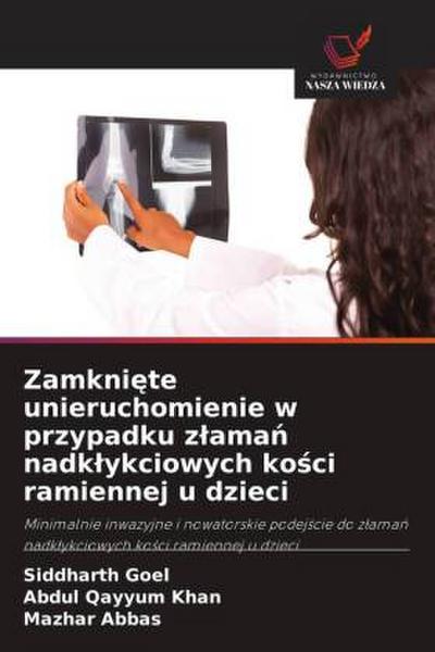 Zamkni¿te unieruchomienie w przypadku z¿ama¿ nadk¿ykciowych ko¿ci ramiennej u dzieci