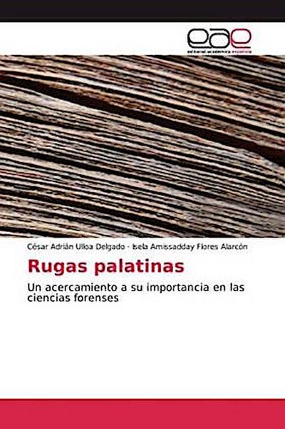 Rugas palatinas