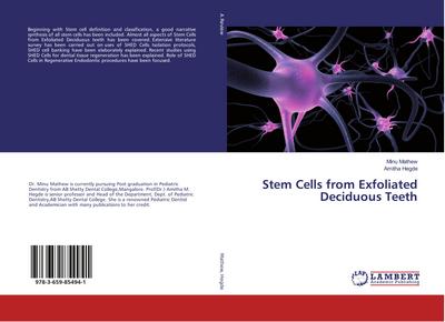 Stem Cells from Exfoliated Deciduous Teeth