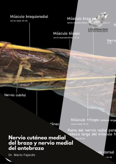 Nervio cutáneo medial del brazo y nervio medial del antebrazo