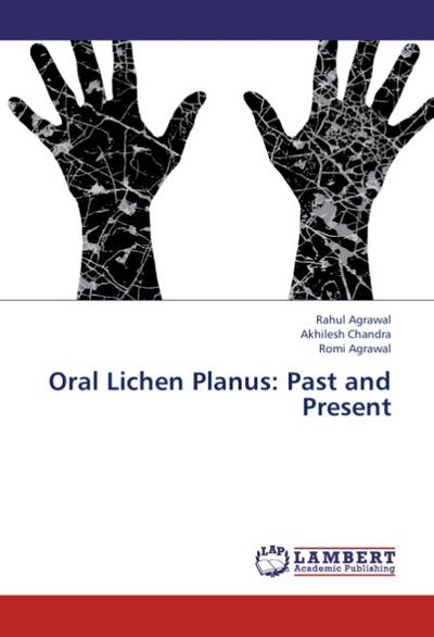 Oral Lichen Planus: Past and Present