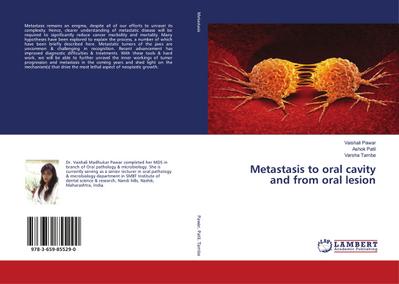 Metastasis to oral cavity and from oral lesion