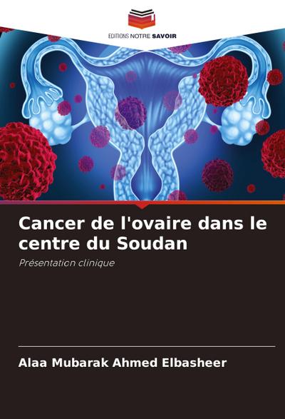 Cancer de l’ovaire dans le centre du Soudan