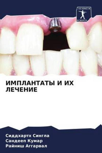 IMPLANTATY I IH LEChENIE