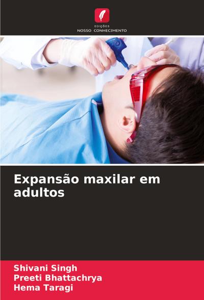 Expansão maxilar em adultos