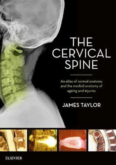 Taylor, J: Cervical Spine