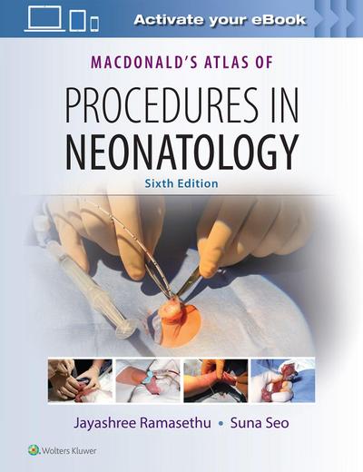 MacDonald’s Atlas of Procedures in Neonatology