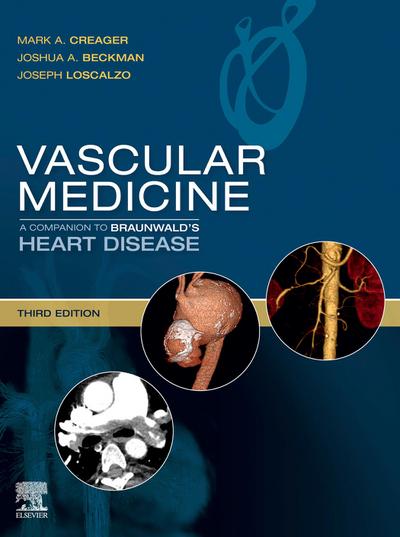 Vascular Medicine: A Companion to Braunwald’s Heart Disease E-Book