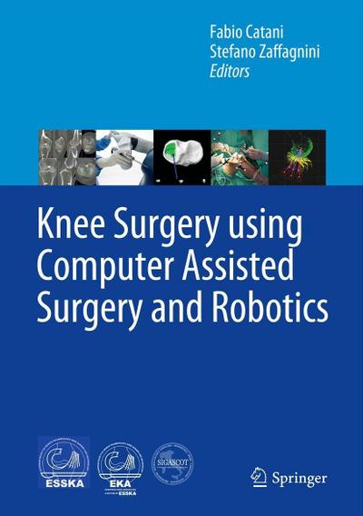 Knee Surgery using Computer Assisted Surgery and Robotics