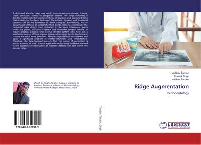 Ridge Augmentation