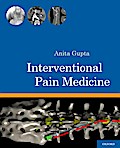 Interventional Pain Medicine