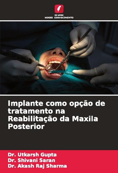 Implante como opção de tratamento na Reabilitação da Maxila Posterior