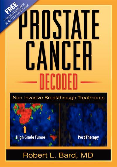 Prostate Cancer Decoded