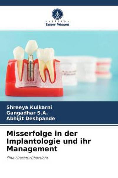 Misserfolge in der Implantologie und ihr Management