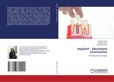 Implant - Abutment Connection