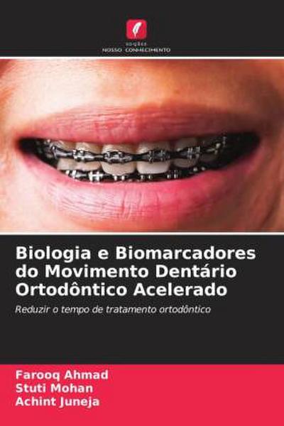 Biologia e Biomarcadores do Movimento Dentário Ortodôntico Acelerado