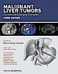Malignant Liver Tumors