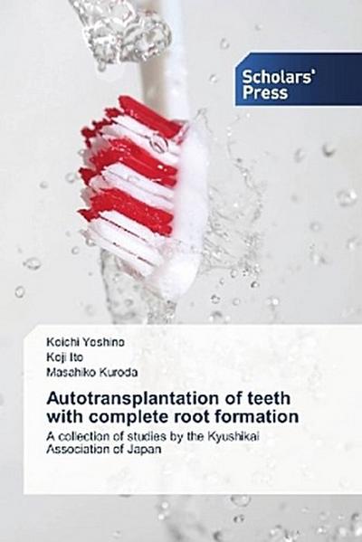 Autotransplantation of teeth with complete root formation