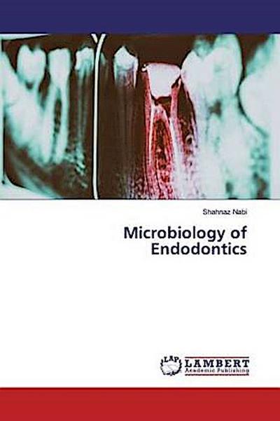 Microbiology of Endodontics