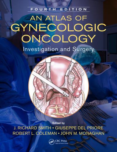 An Atlas of Gynecologic Oncology
