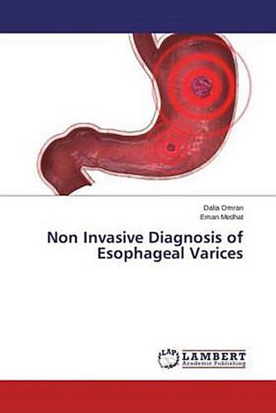 Non Invasive Diagnosis of Esophageal Varices