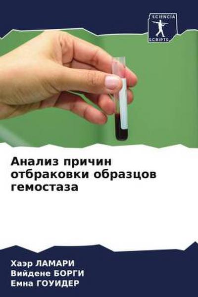Analiz prichin otbrakowki obrazcow gemostaza