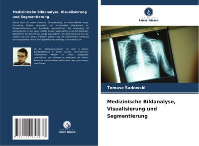 Medizinische Bildanalyse, Visualisierung und Segmentierung