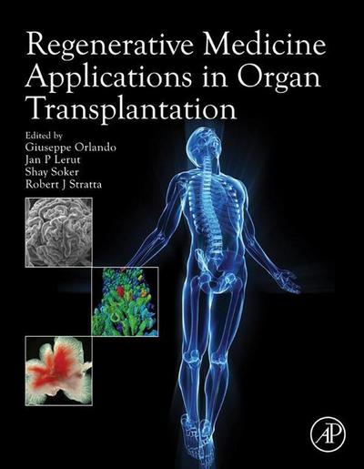 Regenerative Medicine Applications in Organ Transplantation