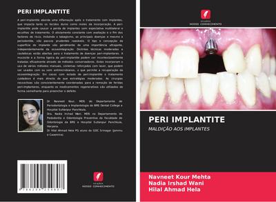 PERI IMPLANTITE