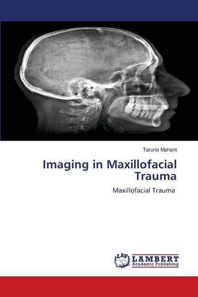 Imaging in Maxillofacial Trauma