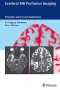 Cerebral MR Perfusion Imaging