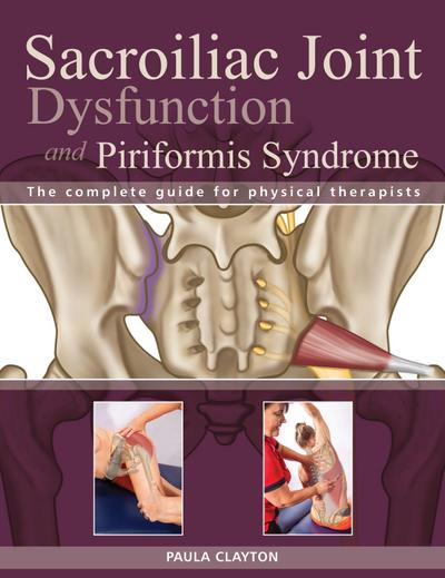 Sacroiliac Joint Dysfunction and Piriformis Syndrome