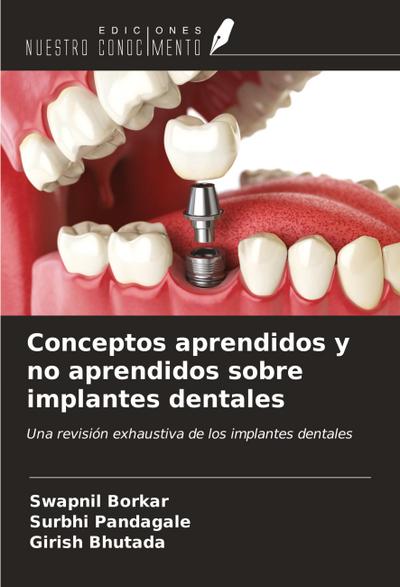Conceptos aprendidos y no aprendidos sobre implantes dentales