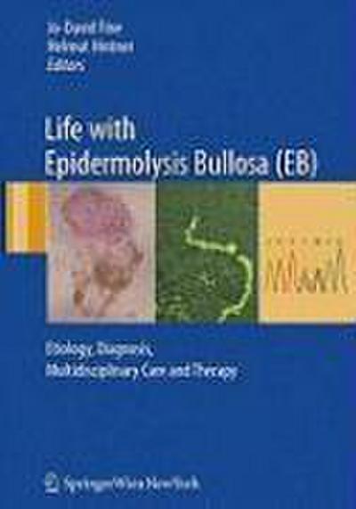 Life with Epidermolysis Bullosa (EB)
