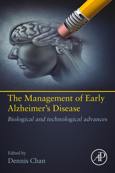 Early Detection of Alzheimer’s Disease