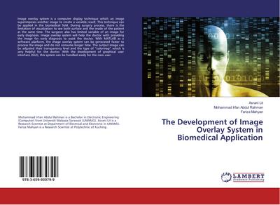 The Development of Image Overlay System in Biomedical Application