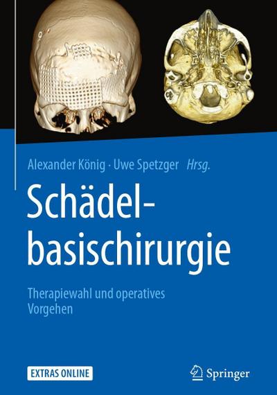 Schädelbasischirurgie